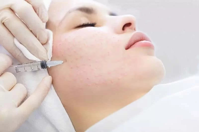 هر کوکتل مزوتراپی برای چند جلسه است ؟